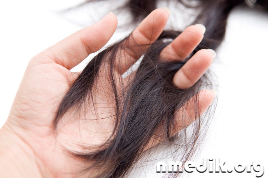 Возможные причины выпадения волос