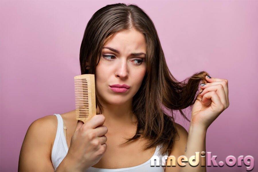 Выпадение волос, самые эффективные методы лечения